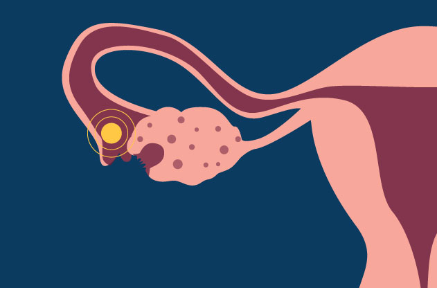 Ovulation: an important event in the female body-omidgenetic